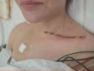 “Que Dios te perdone Fernando”, dijo Nadia Beller y mostró fotos de sus heridas